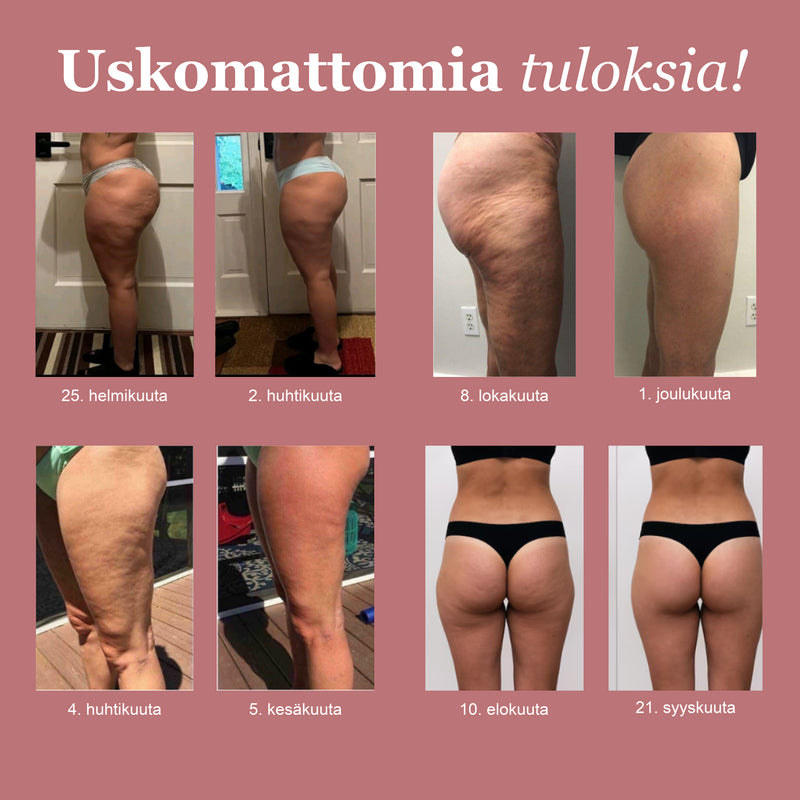 Ennen ja jälkeen -tulos vaaleanpunaisilla LUMIVE-leggingseillä