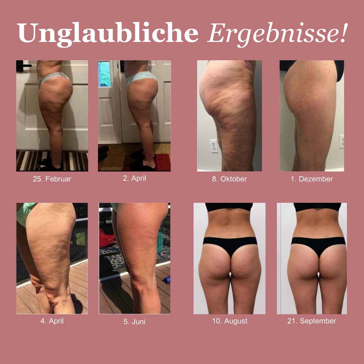 LUMIVE™ 3D-Muotoilevat Kompressioleggingsit